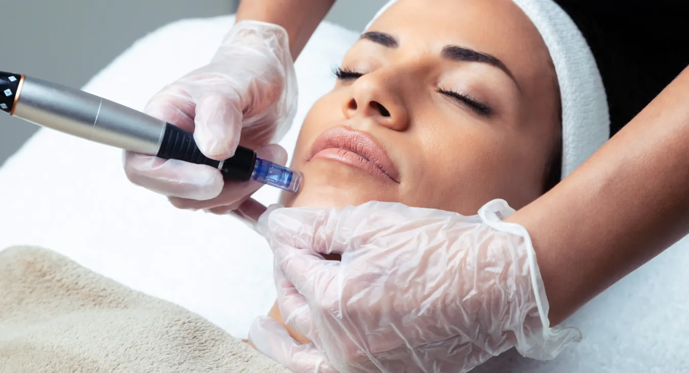Microneedling
